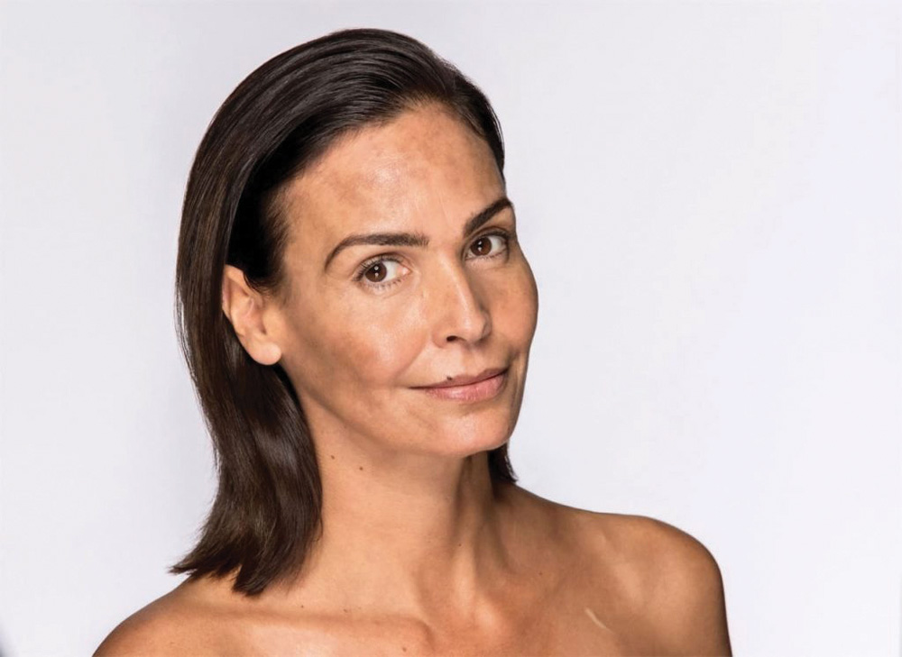Fighting pigmentation